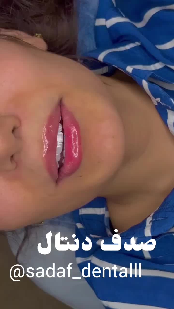 کامپوزیت دندان، روکش، دندانپزشکی تخصصی صدف تهرانسر|خدمات آرایشگری و زیبایی|تهران, تهرانسر مرکزی|دیوار