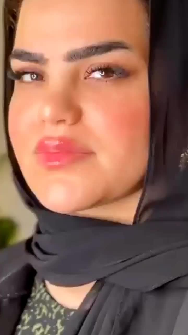 مدل تزریق فیلر برای محتوای اینستا توسط پزشک|خدمات آرایشگری و زیبایی|شاهین‌شهر, فردوسی|دیوار