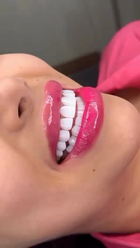 دندانپزشکی/کامپوزیت/عصبکشی/روکش/ترمیم و پالیش|خدمات آرایشگری و زیبایی|قدس, شهرقدس|دیوار