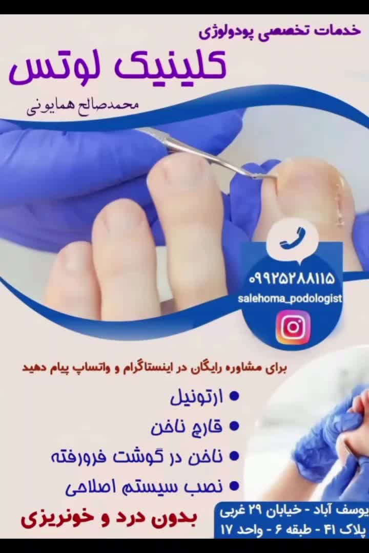 درمان و اصلاح ناخن پا در کلینیک لوتس و منزل|خدمات آرایشگری و زیبایی|تهران, یوسف‌آباد|دیوار