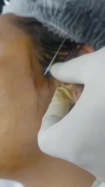 بوتاکس فیلر مزو نخ پی آر پی چربی جوانسازی بدون عمل|خدمات آرایشگری و زیبایی|کرج, گلشهر|دیوار