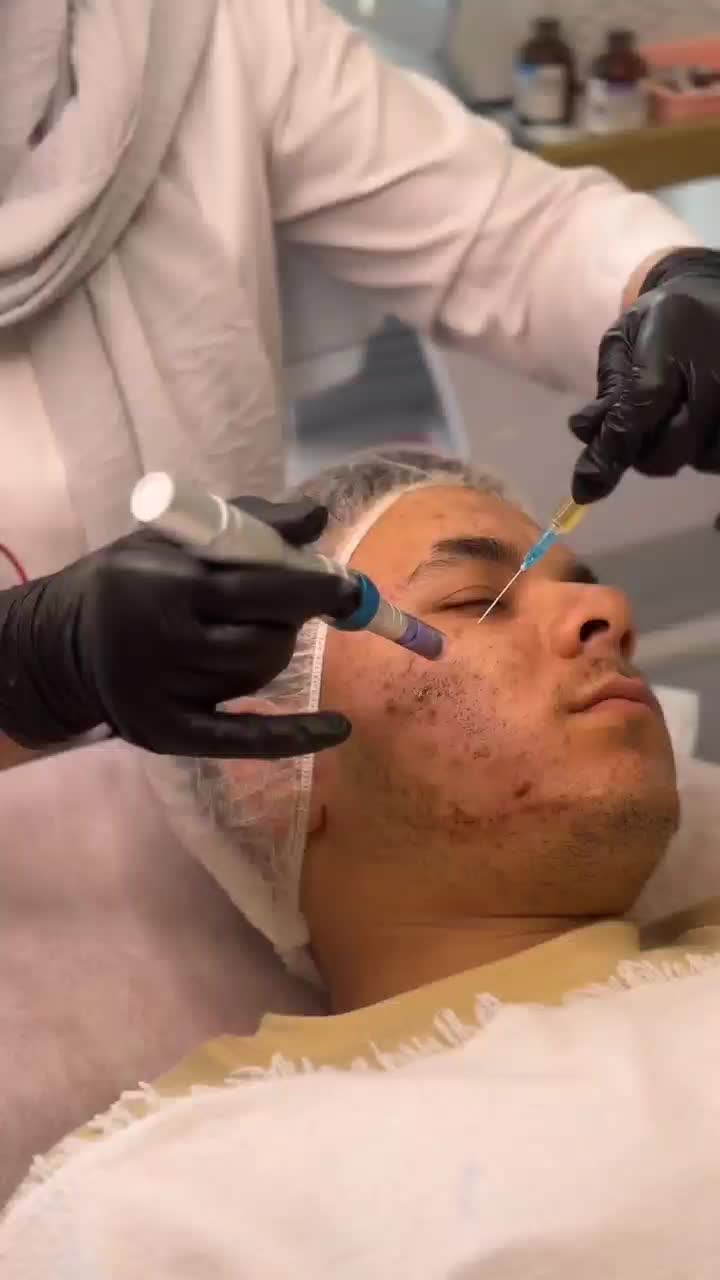 فیشال و پاکسازی پوست|خدمات آرایشگری و زیبایی|بابلسر, |دیوار