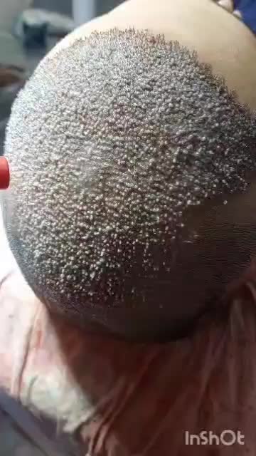 کاشت تخصصی مو در شیراز|خدمات آرایشگری و زیبایی|بوشهر, |دیوار