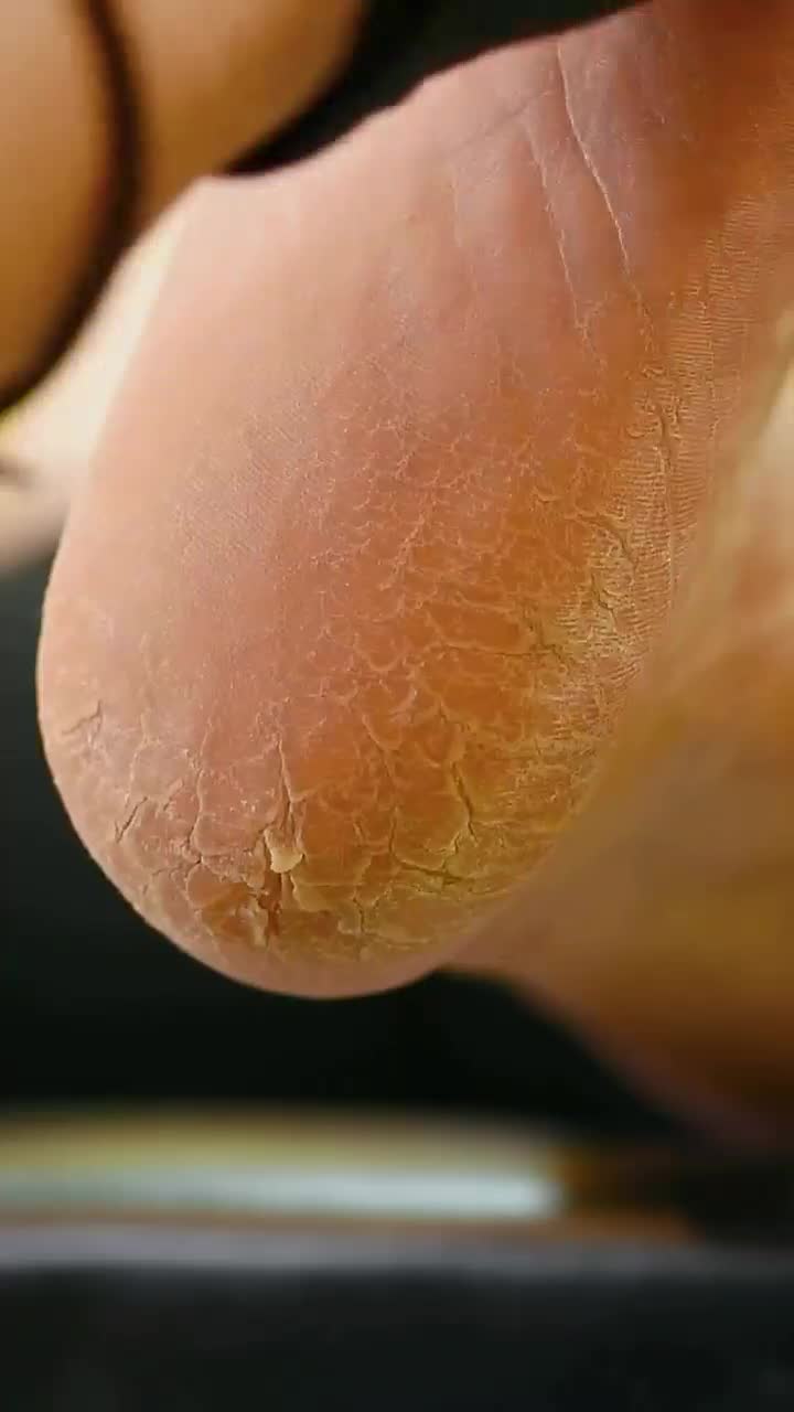 پدیکور تخصصی و درمانی|خدمات آرایشگری و زیبایی|باسمنج, |دیوار