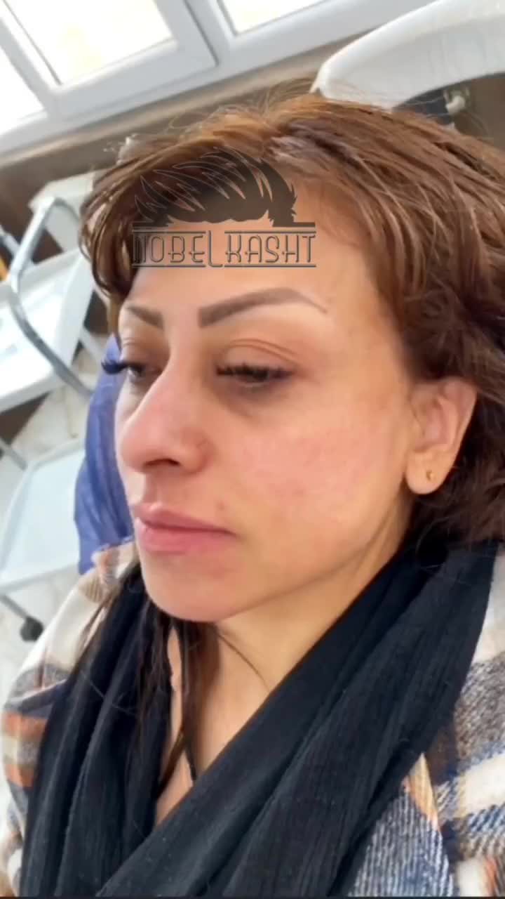 تزریق ژل و بوتاکس با بروزترین تکنیک ها|خدمات آرایشگری و زیبایی|ارومیه, |دیوار