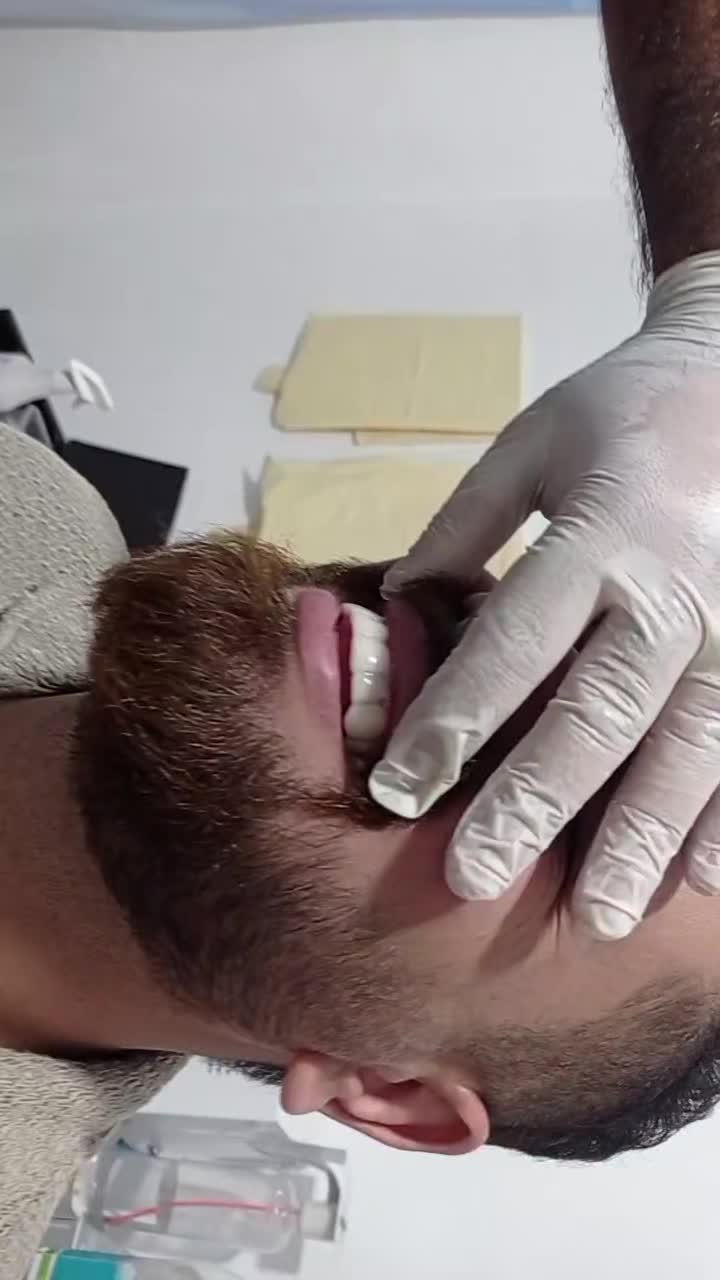 تخفیف فصلی کامپوزیت (1/500ت).عصب کشی در ایرانمهر|خدمات آرایشگری و زیبایی|یاسوج, |دیوار