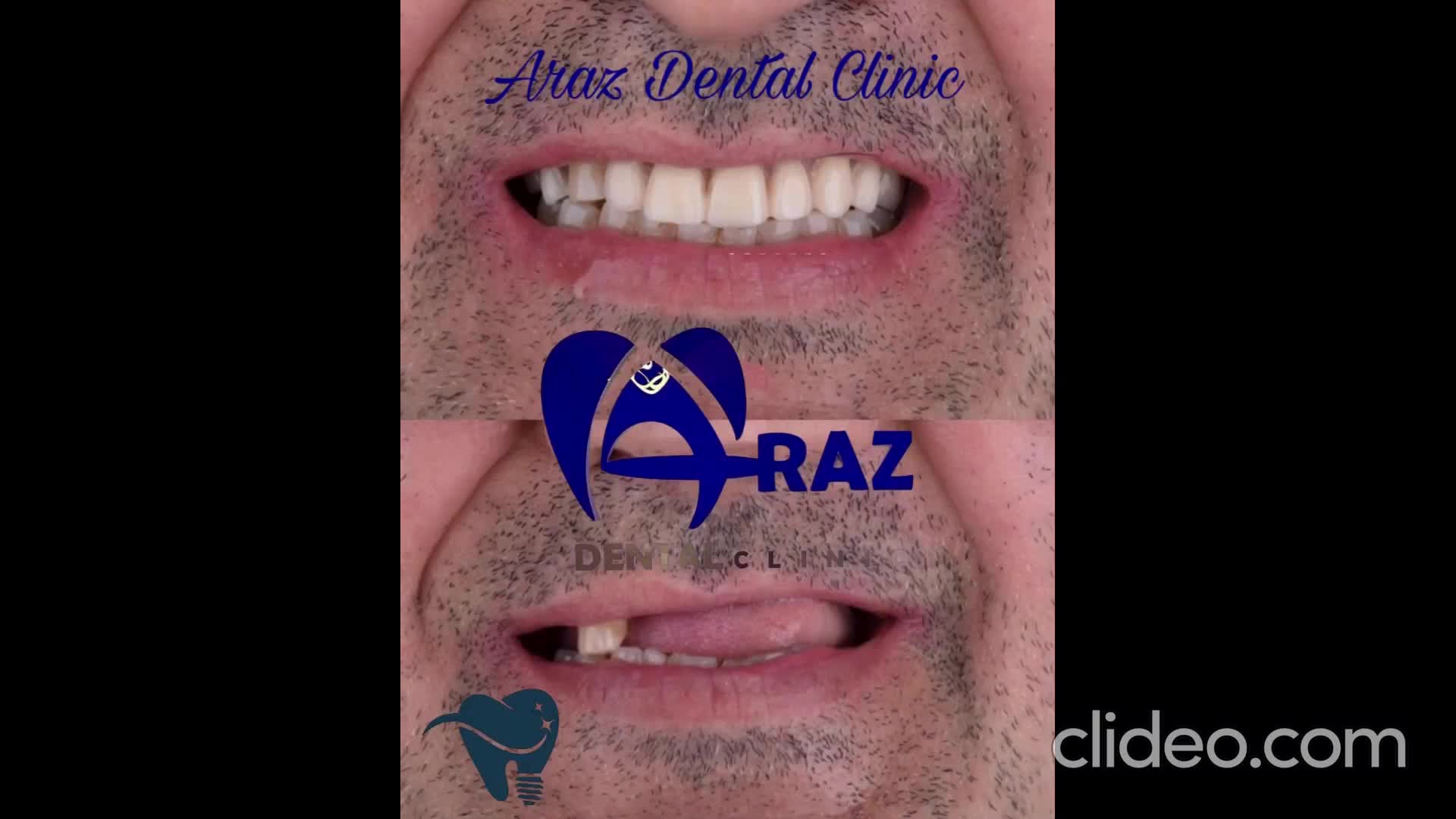 دندانپزشکی/مرکزایمپلنت دیجیتال5100تومان/کاشت‌دندان|خدمات آرایشگری و زیبایی|تهران, پاسداران|دیوار