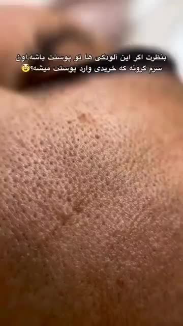 فشیال پوست رفع لک در مطب زیبایی .بانوان -اقایان|خدمات آرایشگری و زیبایی|شیراز, رازی|دیوار