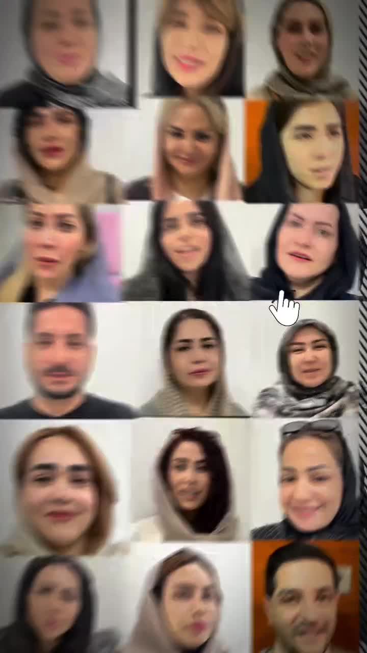 بلفاروپلاستی(جراحی پلک بالا و پایین)توسط چشم پزشک|خدمات آرایشگری و زیبایی|یاسوج, |دیوار