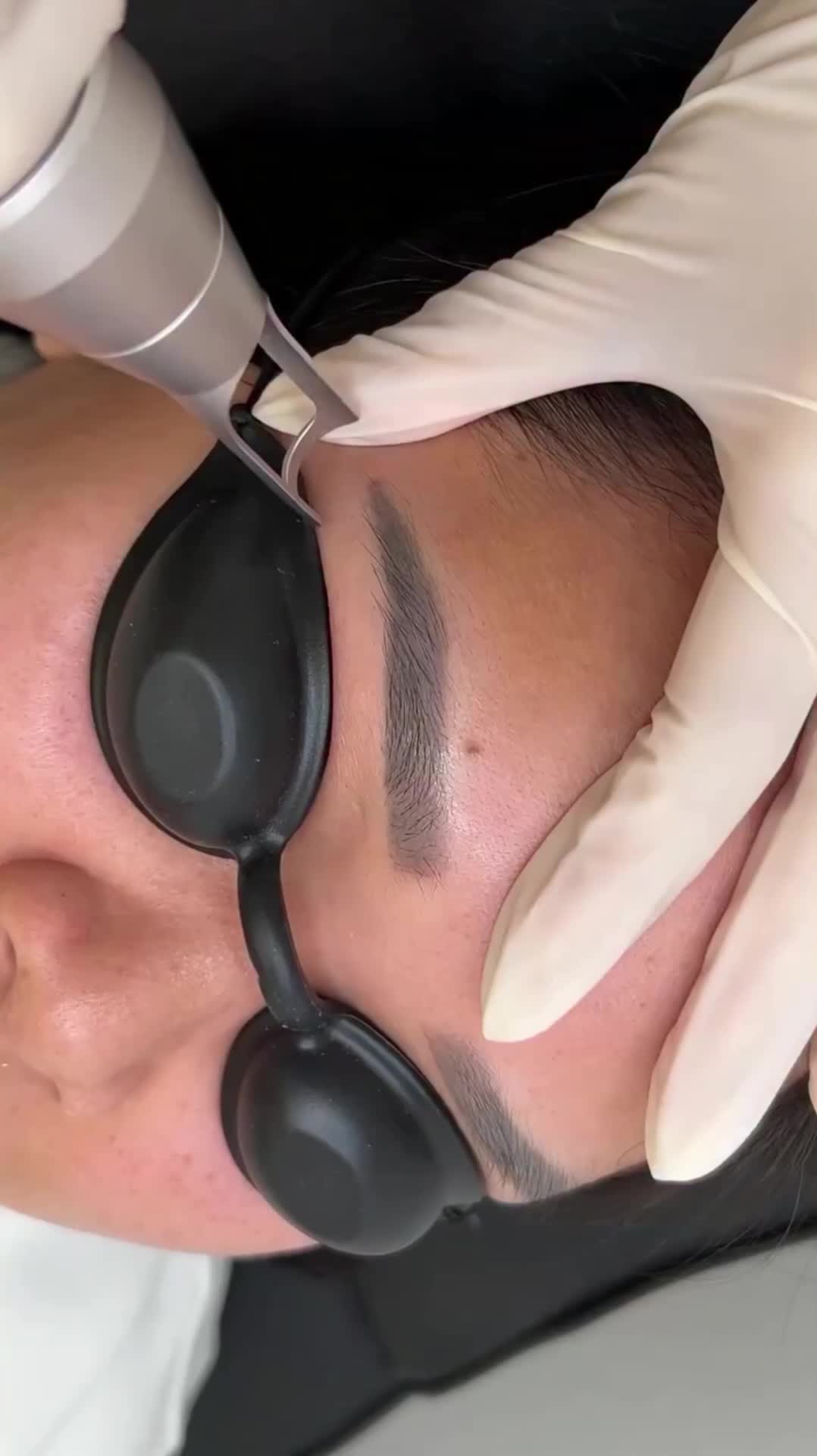 بوتاکس،فیلر، ژل ،ریموو تتو|خدمات زیبایی و سلامت|کرمانشاه, |دیوار
