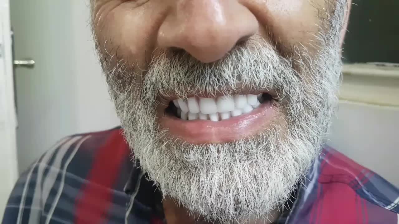 دندان مصنوعی طرح لبخند(کامپوزیت) ارتودنسی ، پیروزی|خدمات آرایشگری و زیبایی|تهران, صد دستگاه|دیوار