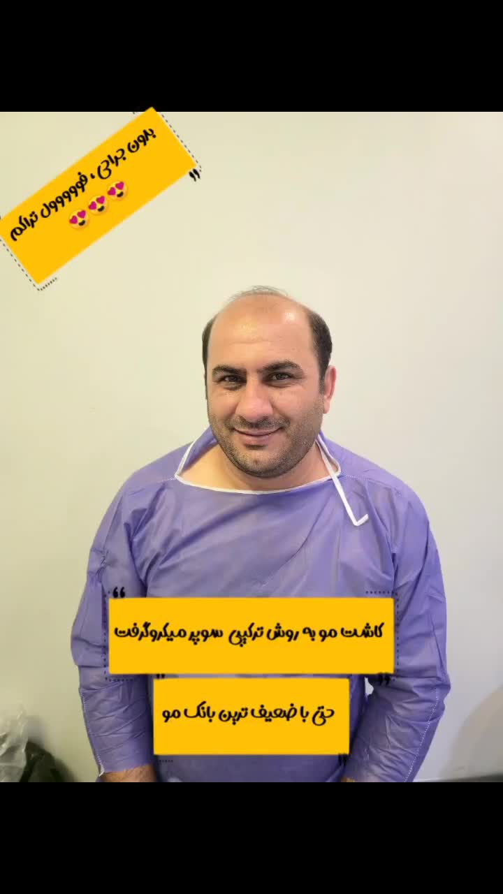 کاشت مو و ابرو|آرایشی، بهداشتی، درمانی|کرج, دانشگاه هنر تهران (پردیس کرج)|دیوار