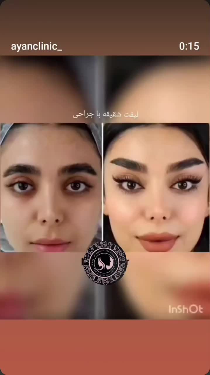 خدمات پوست و زیبایی مجاز|خدمات آرایشگری و زیبایی|شیراز, چوگیاه|دیوار