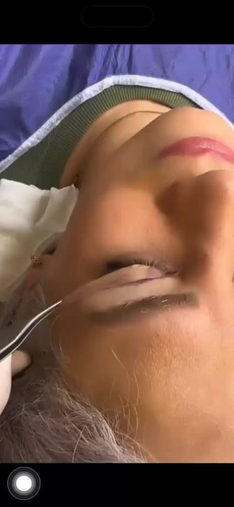 جراحی بلفاروپلاستی|خدمات آرایشگری و زیبایی|تهران, هفت حوض|دیوار