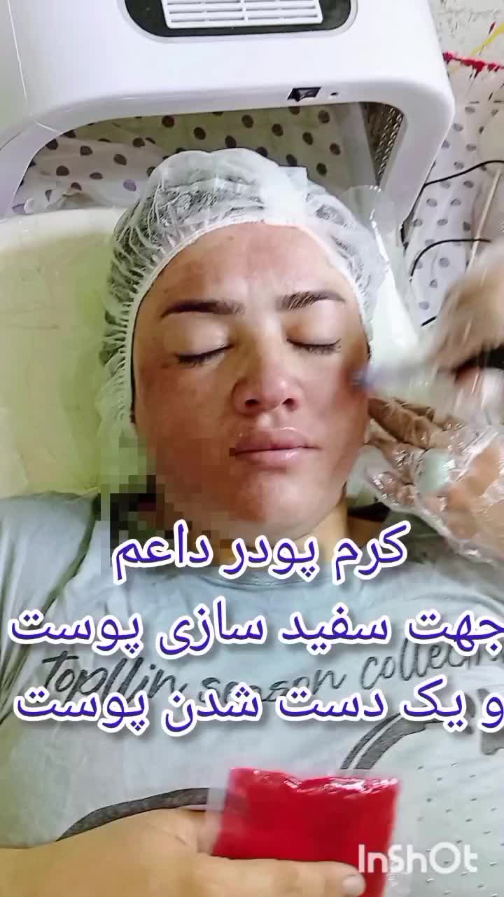 برداشتن خال،پرسینگ،چال گونه،میکرودرمال،کرم پودر|خدمات آرایشگری و زیبایی|کرمانشاه, |دیوار