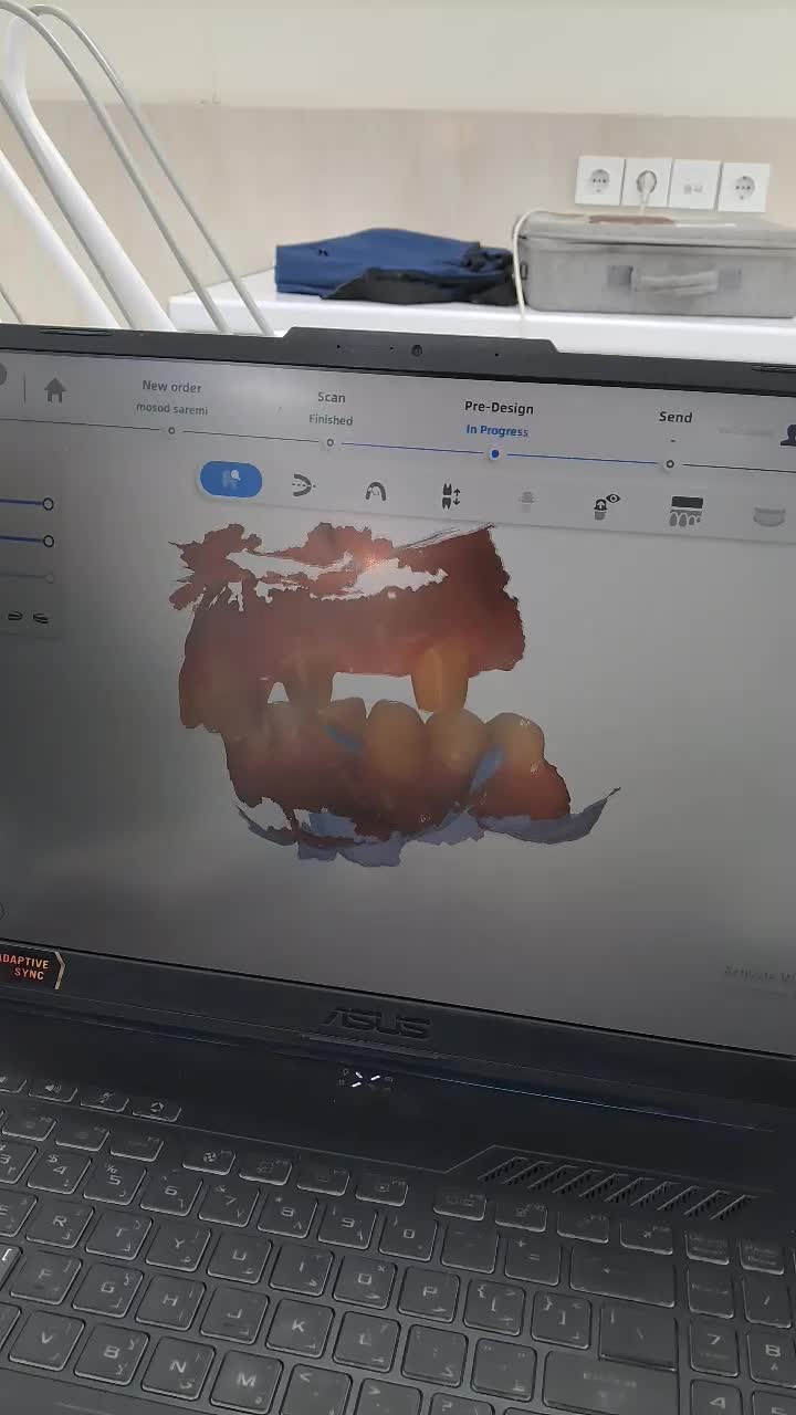 تخفیف وام دندانپزشکی ایمپلنت کامپوزیت روکش عصب کشی|خدمات آرایشگری و زیبایی|بروجرد, |دیوار