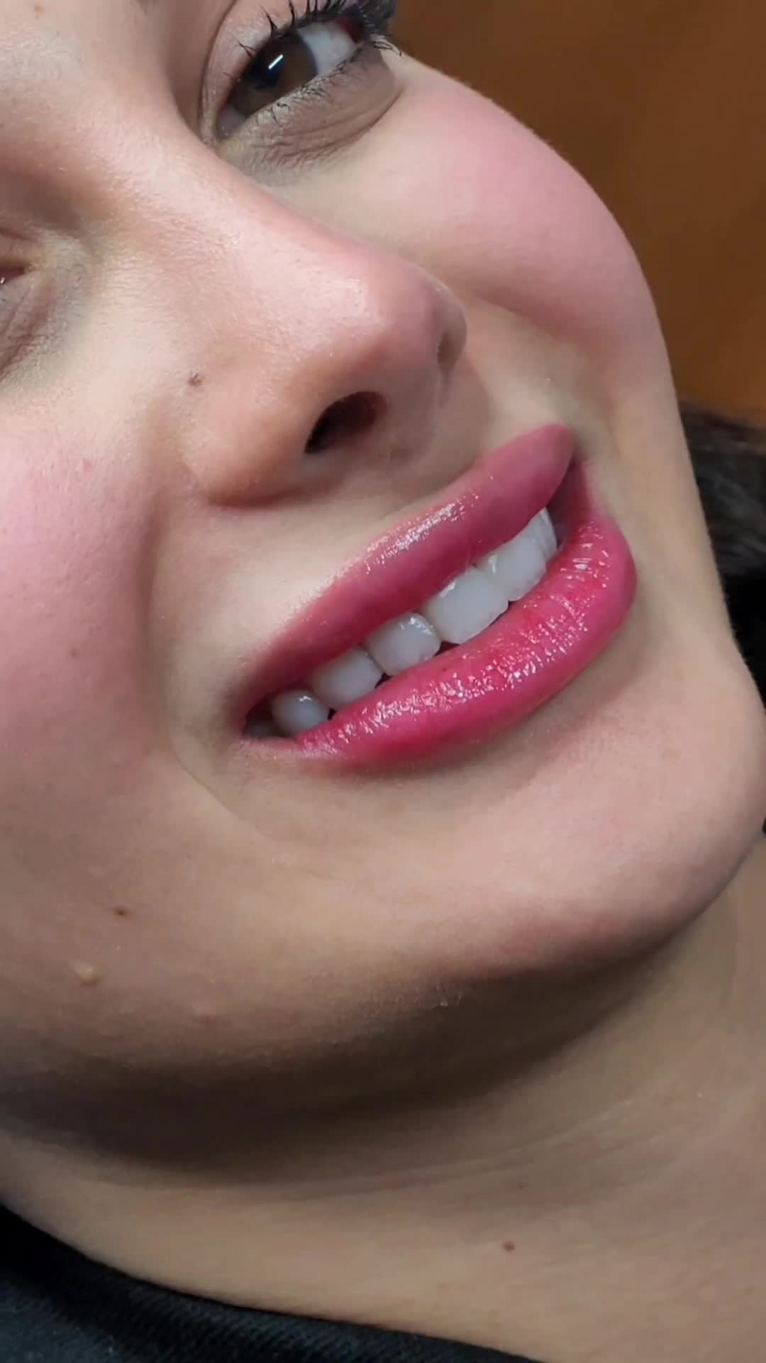 کامپوزیت زیبایی دندان|خدمات آرایشگری و زیبایی|رشت, دباغیان|دیوار