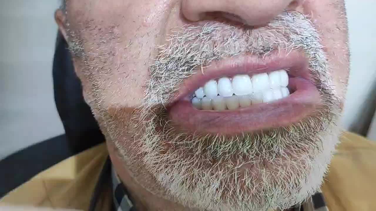 دندانسازی (فقط با ۱۵ میلیون )|خدمات آرایشگری و زیبایی|پرند, فاز ۲|دیوار