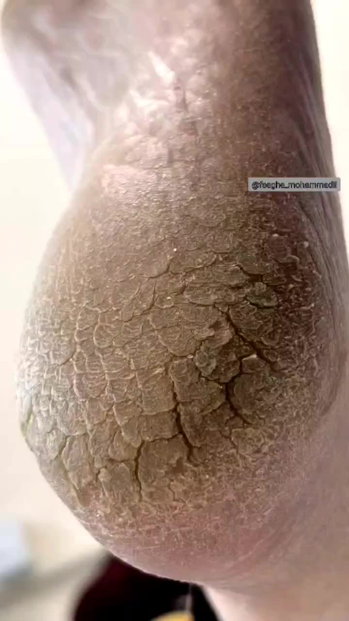 پدیکور ،موخوره گیری،مانیکور خیس،پارافین دست و پا|خدمات آرایشگری و زیبایی|بیرجند, |دیوار