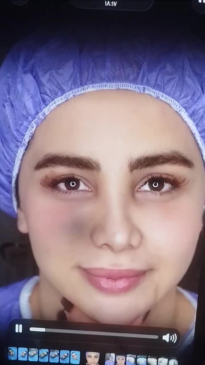 جراحی لیفت صورت (مکس لیفت)|خدمات آرایشگری و زیبایی|ساری, |دیوار