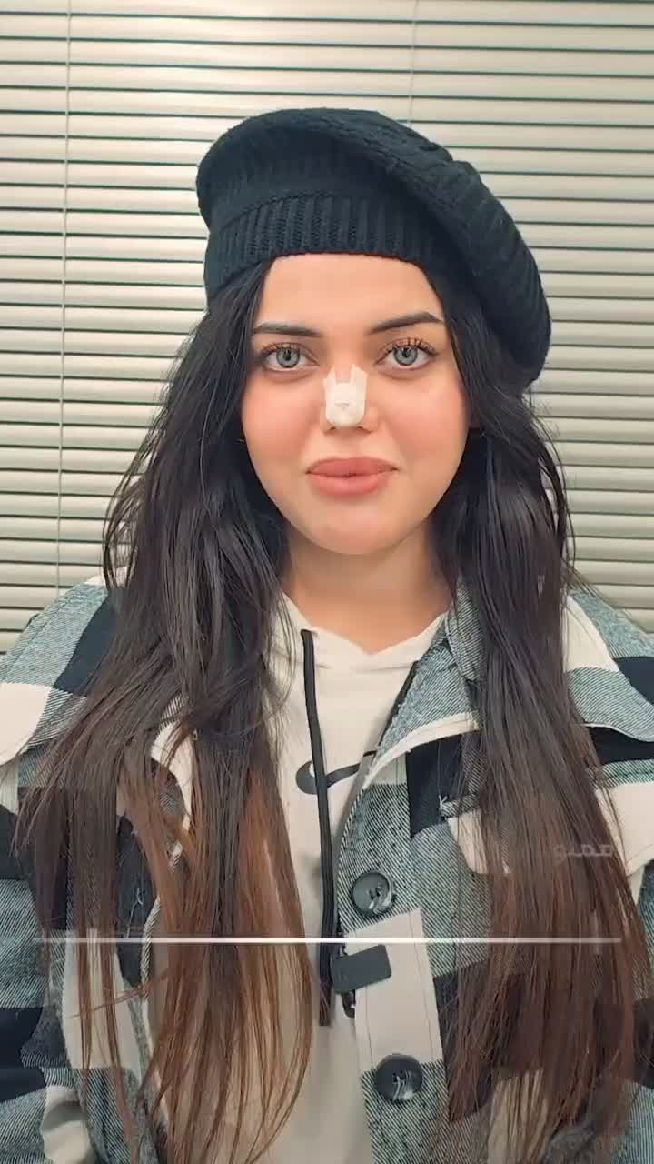 قرعه کشی صد میلیون تومنی عمل بینی|خدمات آرایشگری و زیبایی|شیراز, ستارخان|دیوار