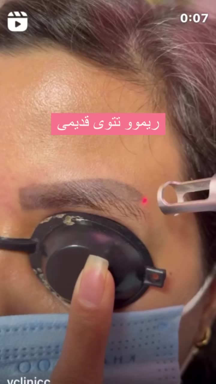 فروش دستگاه پیکشورگریدa|پزشکی|اصفهان, شیخ اشراق|دیوار