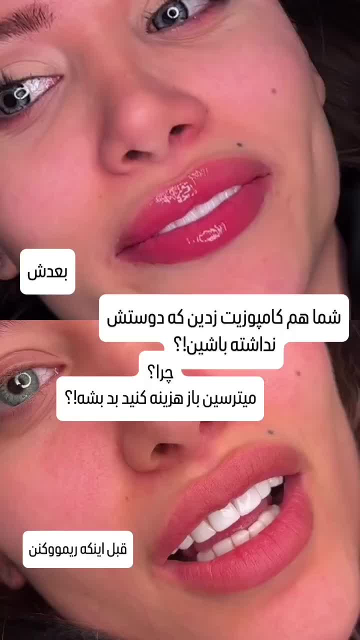 کامپوزیت فکی۵میلیون‌،عصبکشی۹۰۰تمام‌خدمات دندان قسط|خدمات آرایشگری و زیبایی|قدس, |دیوار