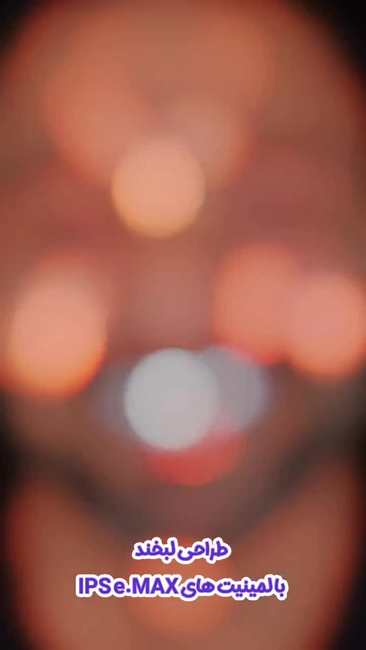 دندانپزشکی شهرقدس (ایمپلنت،لمینیت،کامپوزیت)|خدمات آرایشگری و زیبایی|قدس, شهر‌قدس|دیوار