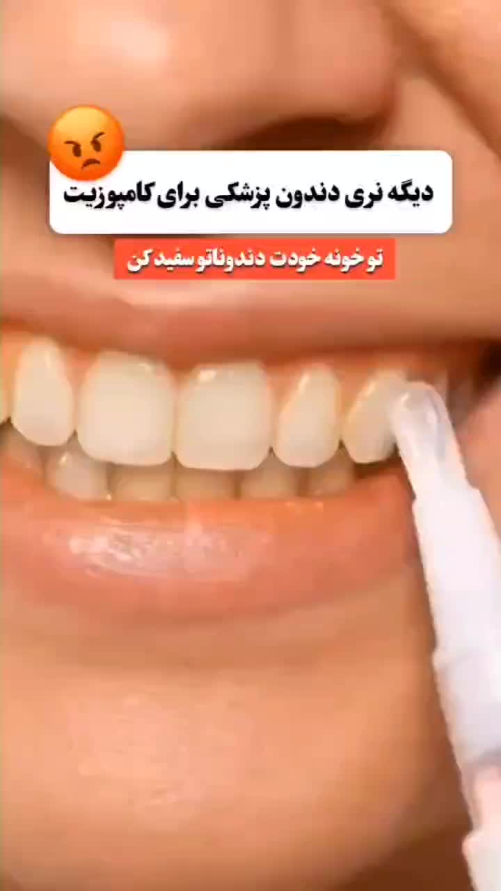 قلم سفید کننده دندان /لمینت/زیبایی/کامپوزیت|خدمات آرایشگری و زیبایی|سبزوار, عظیمیان|دیوار
