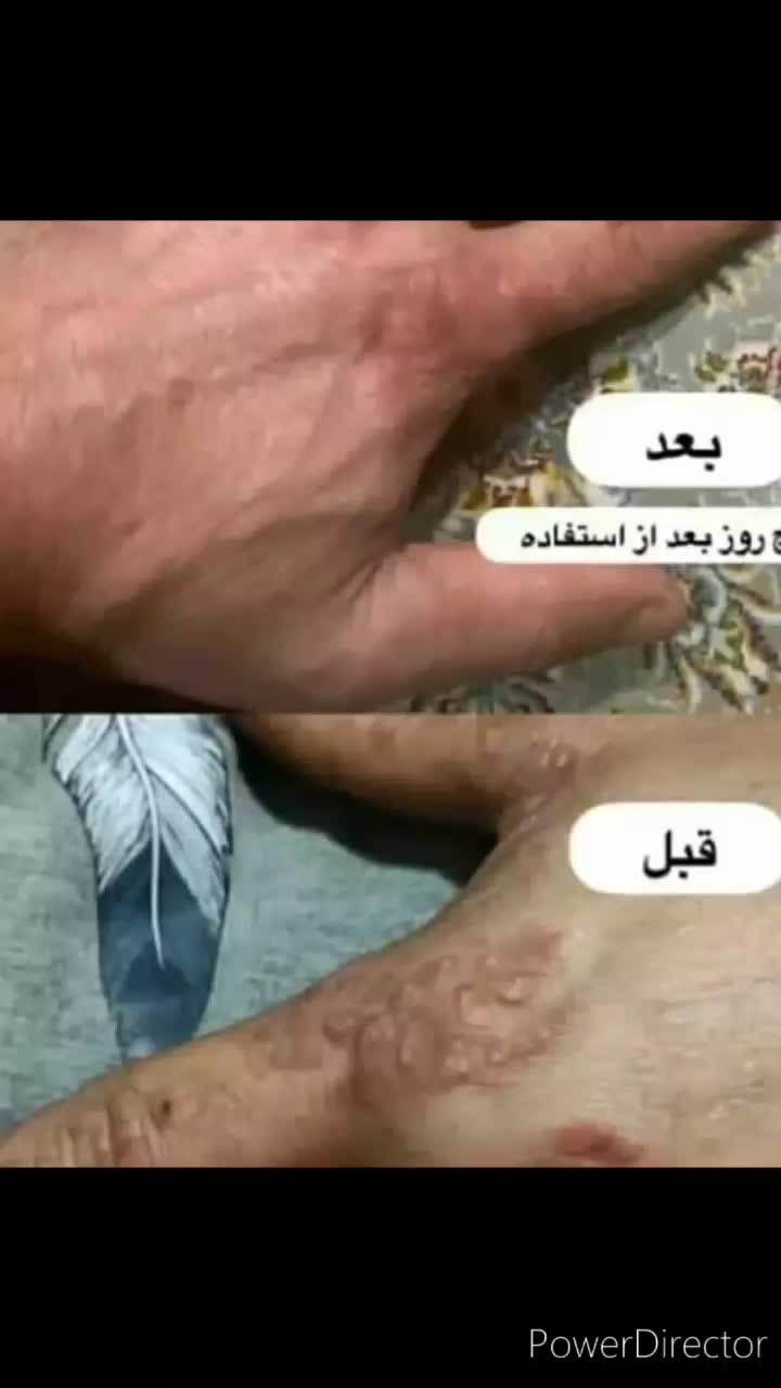 پماد شاهو|آرایشی، بهداشتی، درمانی|تهران, آجودانیه|دیوار