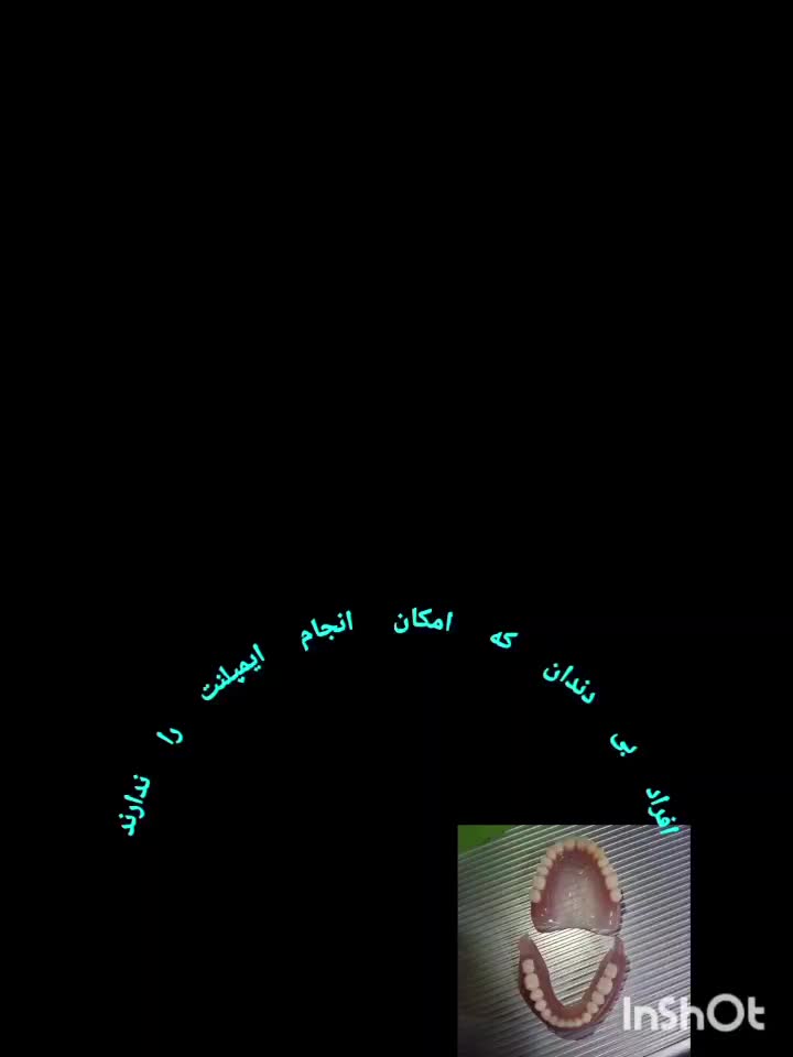 ساخت دندان مصنوعی اقتصادی وبا کیفیت|خدمات آرایشگری و زیبایی|ری, دیلمان|دیوار