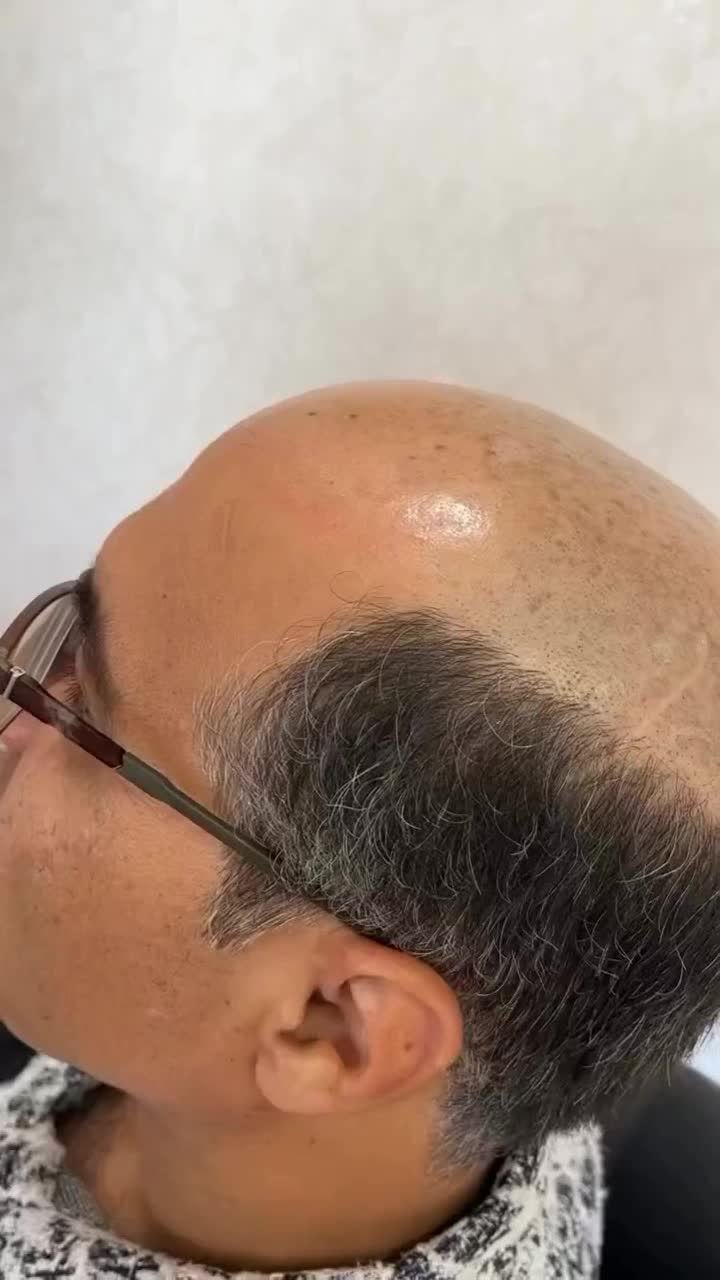 فروش و نصب پروتز موی طبیعی و چسب پروتز ریموور|خدمات آرایشگری و زیبایی|اردبیل, |دیوار