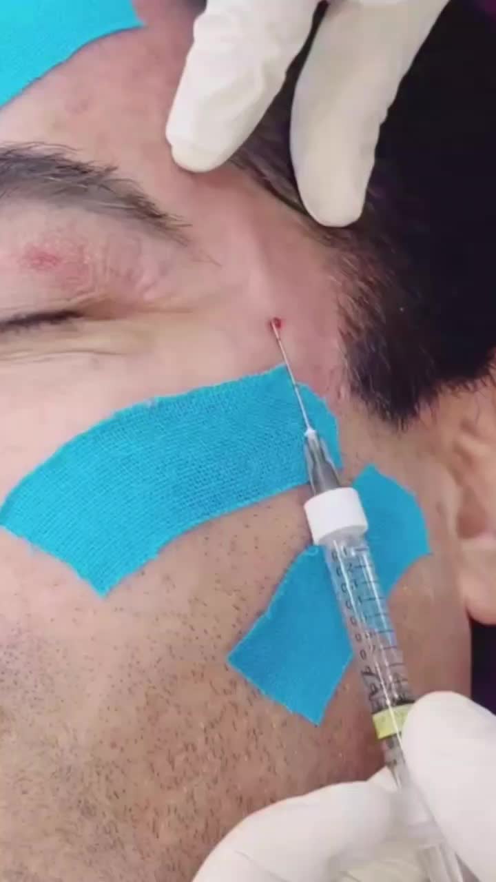 ژل وبوتاکس ومزونیدلینگ وحجامت|خدمات آرایشگری و زیبایی|فولادشهر, B2|دیوار