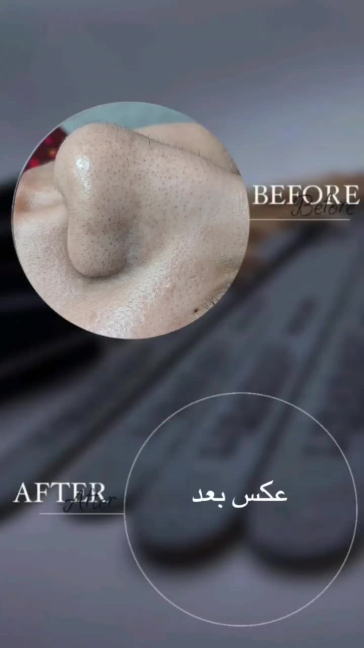 تخفیف صدهزار تومانی فیشال وپاکسازی تا شب یلدا|خدمات آرایشگری و زیبایی|بم, |دیوار