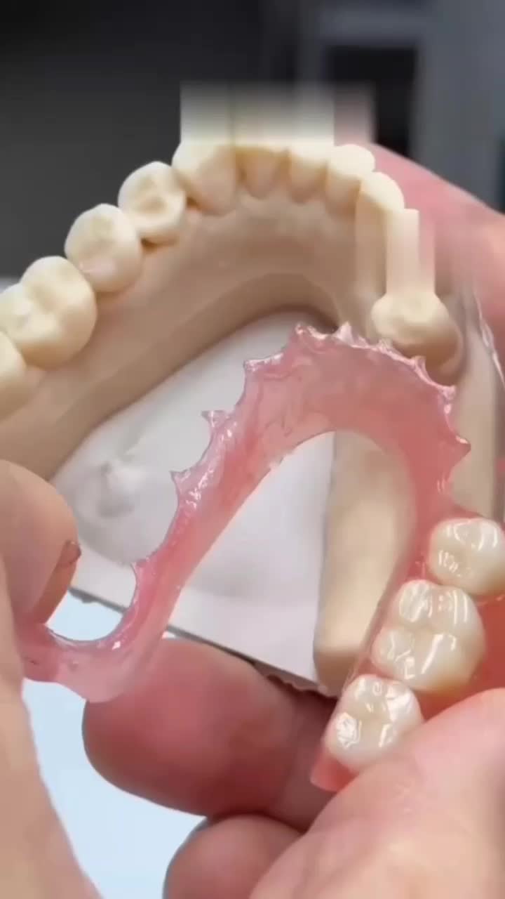 دست دندان طرح لمینیت|خدمات زیبایی و سلامت|تهران, شمسآباد|دیوار