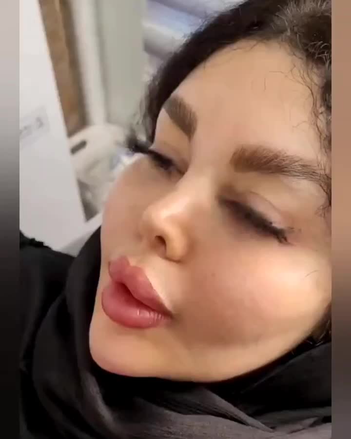 آموزش فیلر ژل بوتاکس نخ لیفت لیزر مو فشیال طب سنتی|خدمات آموزشی|اصفهان, سعادت‌آباد|دیوار