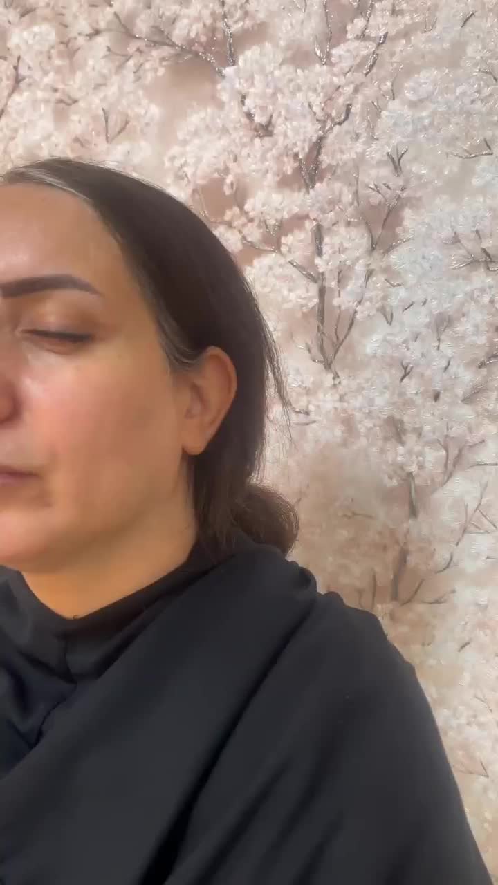 فیلر بوتاکس جوانساز جراحی بادی نخ مزو هیرفیلر|خدمات آرایشگری و زیبایی|تهران, پاسداران|دیوار