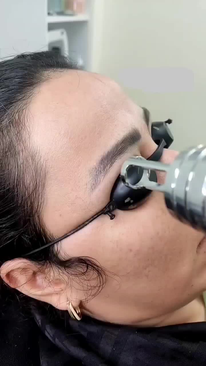 جشنواره لیزر ریمو تتو ابرو وبدن در مطب پزشک|خدمات آرایشگری و زیبایی|قم, بلوار امین و ساحلی|دیوار