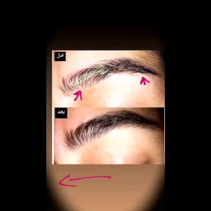محلول رویش و رشد مجدد ابرو و مژه|آرایشی، بهداشتی، درمانی|مشهد, موسوی قوچانی|دیوار