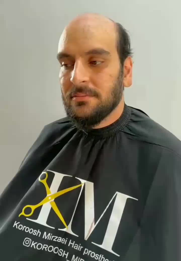 نصب پروتزمو/تعویض چسب پروتزمو/ترمیم/درمحل/وسالنvip|خدمات زیبایی و سلامت|تهران, فلسطین (میدان انقلاب)|دیوار