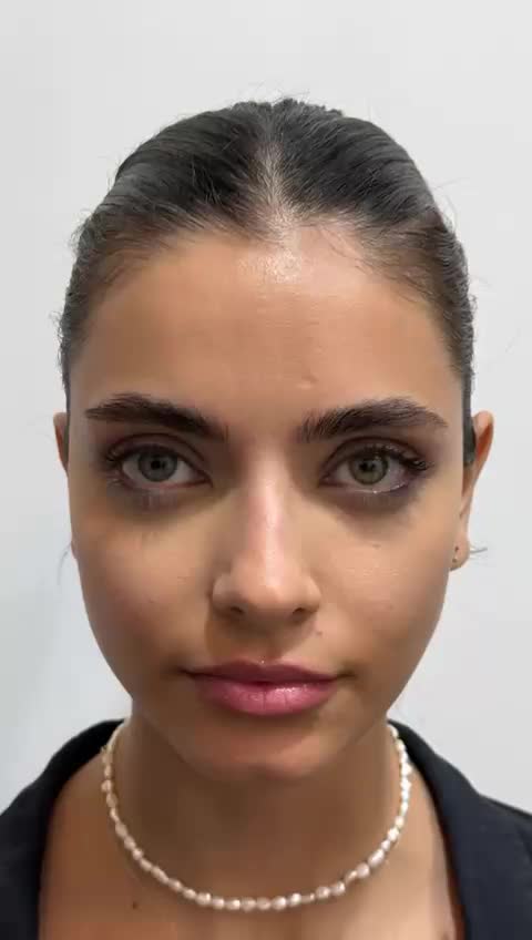 انجام خدمات ژل و بوتاکس و تمامی جراحی ها|خدمات آرایشگری و زیبایی|شهریار, شهریار|دیوار