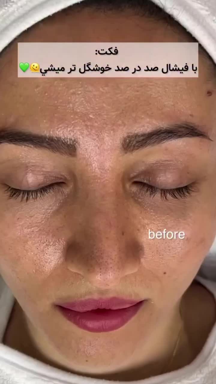آموزشی تخصصی مراقبت و پاکسازی پوست|خدمات آموزشی|رشت, دیلمان|دیوار