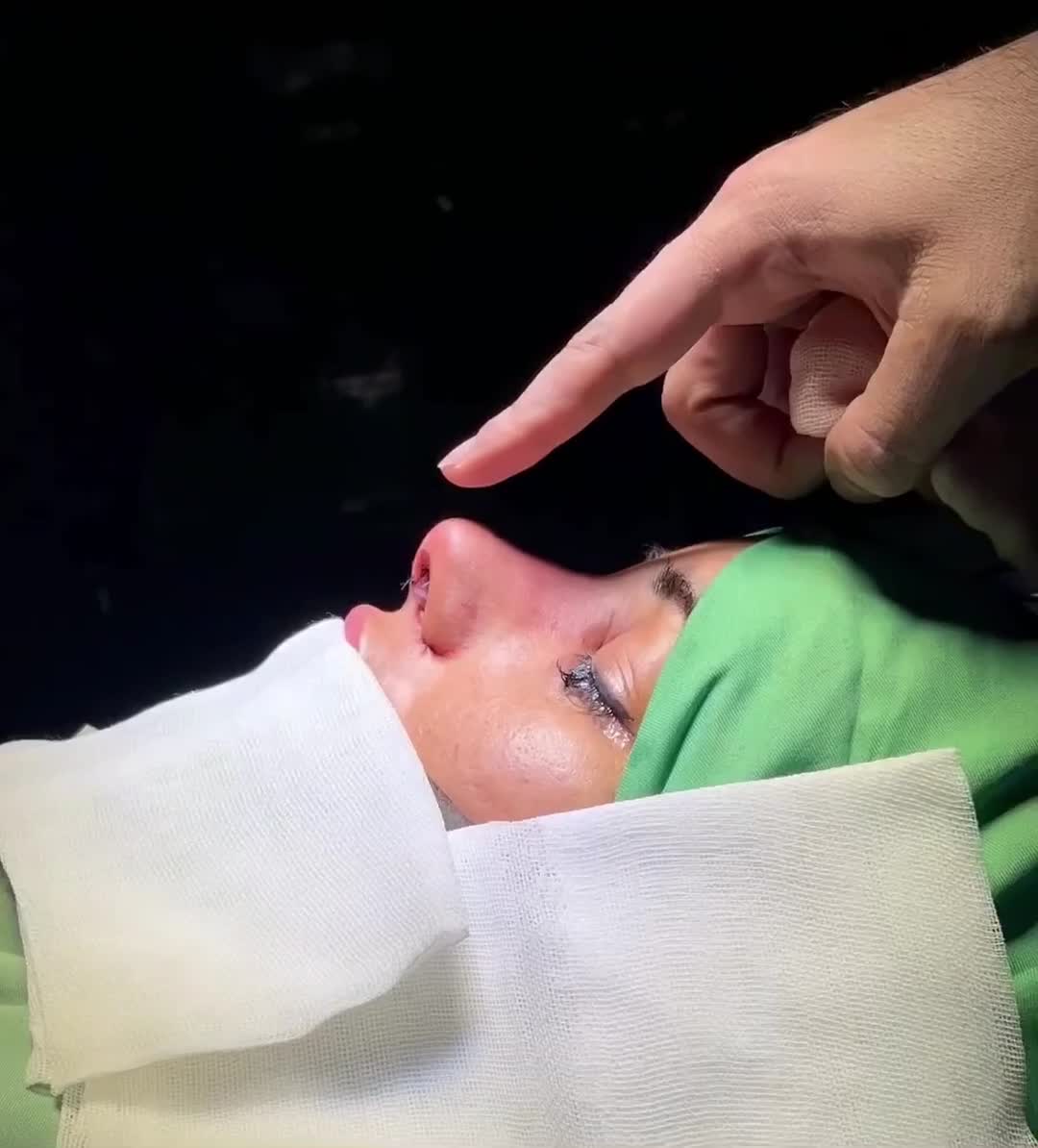 جراحی زیبایی بینی رینوپلاستی اصفهان توسط متخصص ent|خدمات زیبایی و سلامت|اصفهان, عباسآباد|دیوار