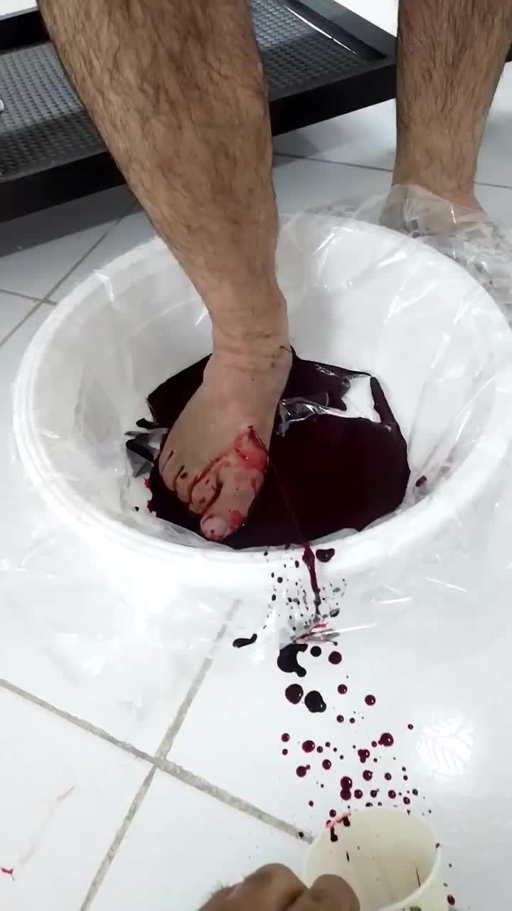 حجامت. فصد. زالو درمانی.|خدمات آرایشگری و زیبایی|مشهد, شاهد (شهرک غرب)|دیوار