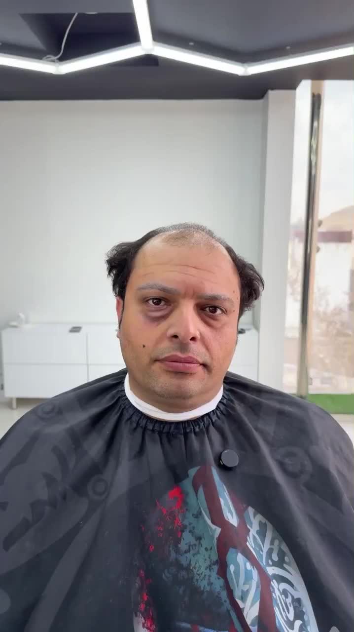 کاشت مو ابرو ریش اقساط کاشتمو سوپرvip در شیراز، ستارخان، بلوار ستارخان