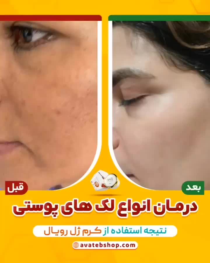 کرم ضدلک جوانسازرویال|آرایشی، بهداشتی، درمانی|بندر کنگان, |دیوار