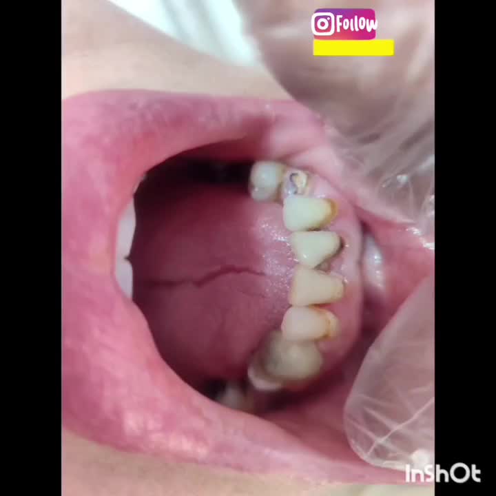 دندانسازی لبخند|خدمات آرایشگری و زیبایی|مهاباد (آذربایجان غربی), |دیوار