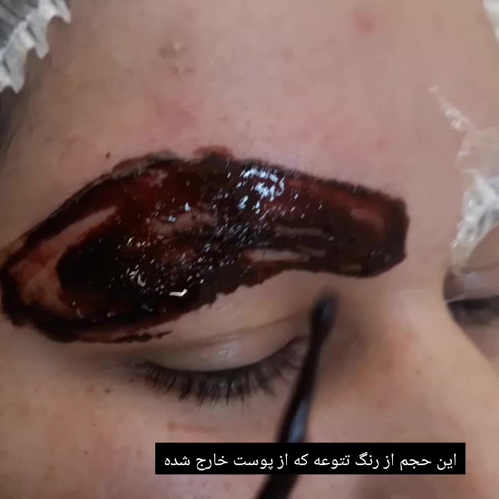 ریموو تخصصی پاک کردن تتو ابرو و خط چشم تضمینی|خدمات آرایشگری و زیبایی|بروجرد, |دیوار