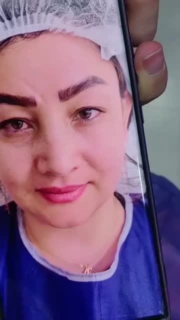 مدل بلفارو پلاستی لیفت ابرو کاشت ابرو سانترال لب|خدمات آرایشگری و زیبایی|تهران, پونک|دیوار