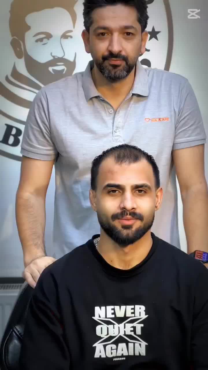 پروتزمو پروتز مو VIP تغییر چهره در چند ساعت|خدمات زیبایی و سلامت|تهران, دیلمان|دیوار